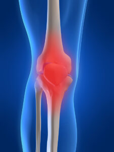 osteoporosis