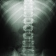 xray xray